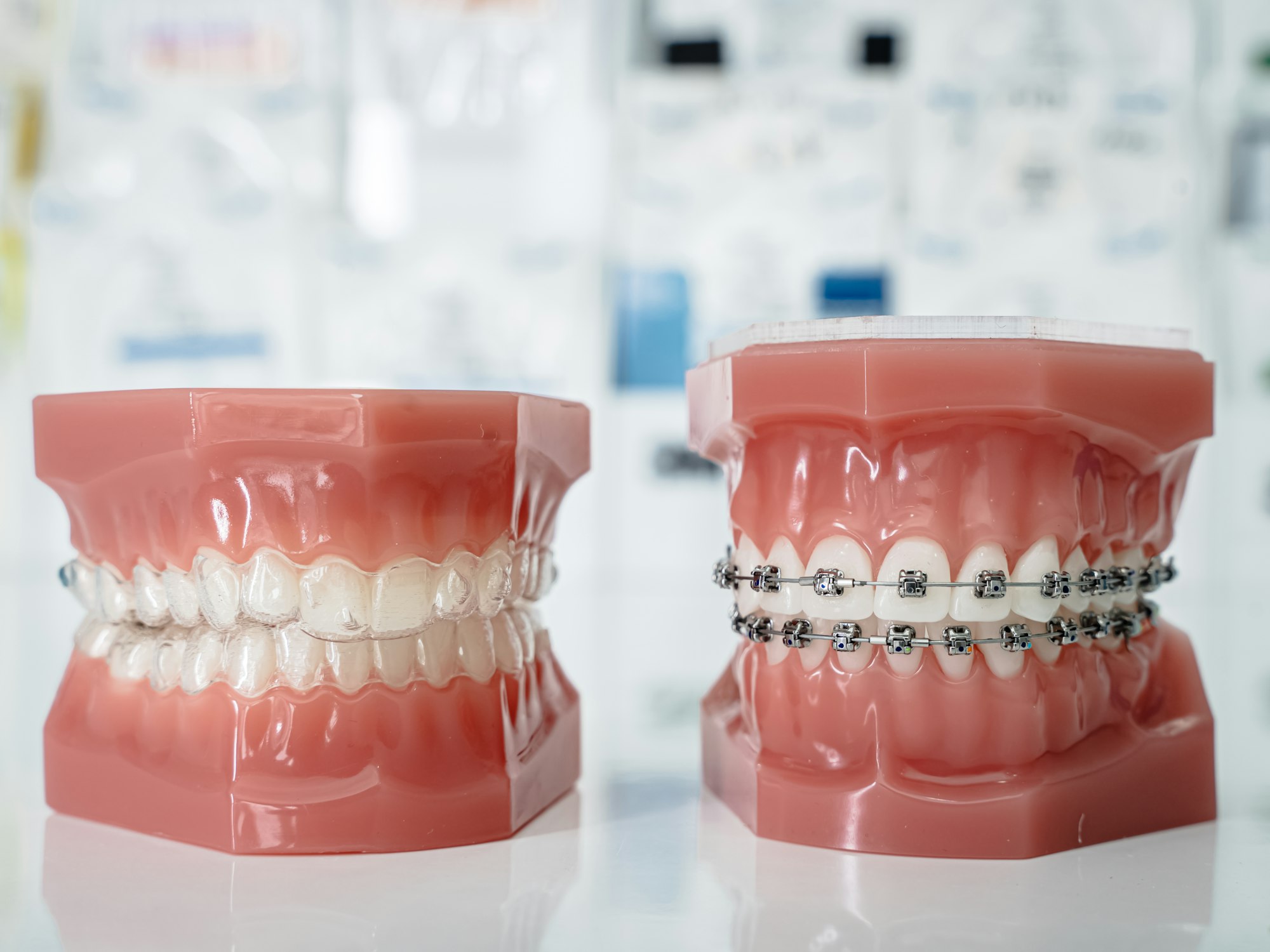 Two dental models side by side, one fitted with a clear aligner and one with metal braces