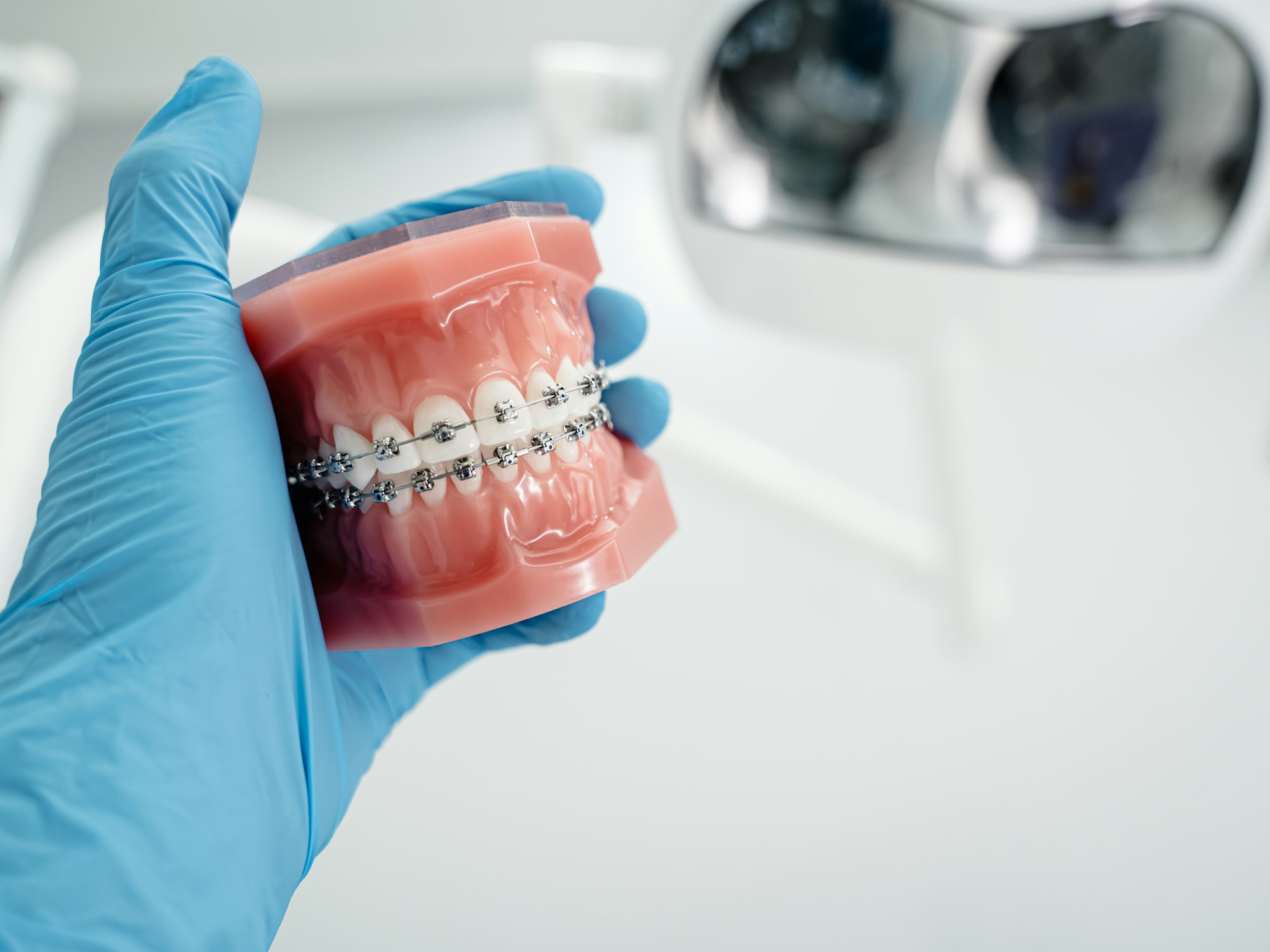 A gloved hand holding a dental model fitted with metal braces