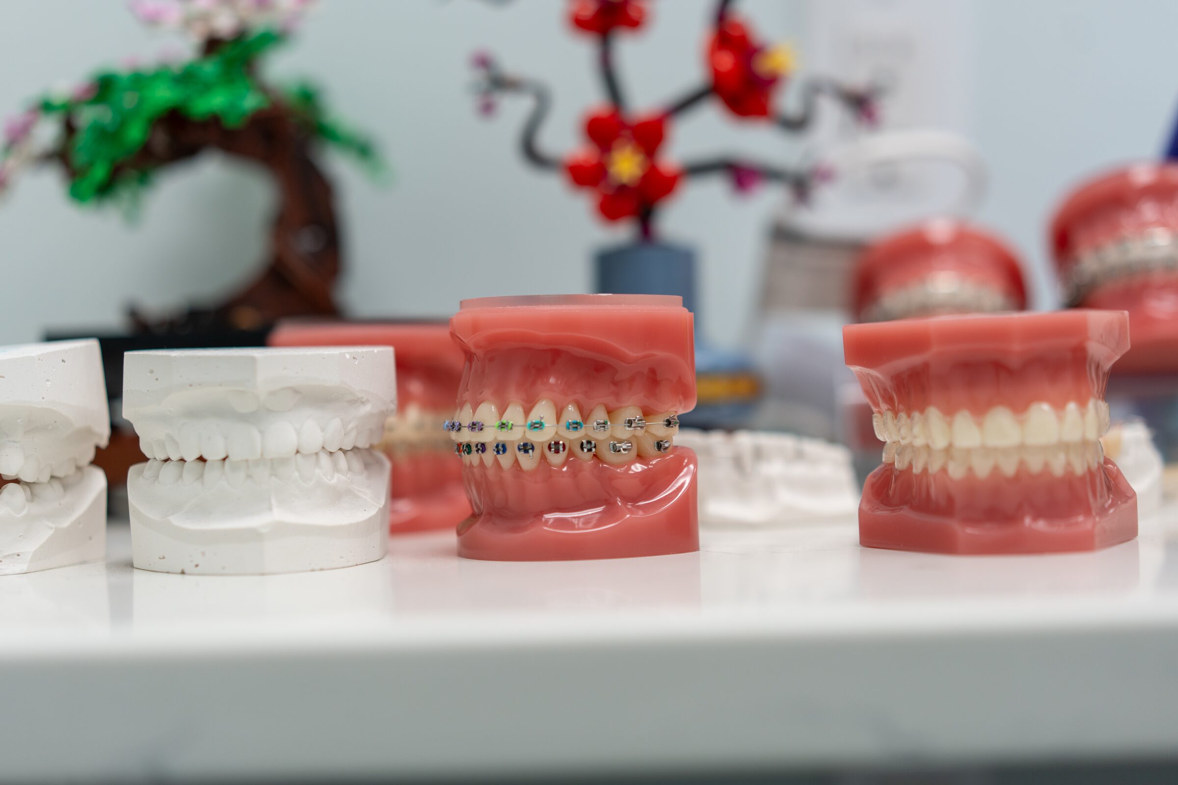 Dental models on the counter showing metal, ceramic and clear braces