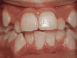 Before treatment