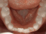 Before treatment