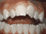 Before treatment