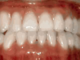 After treatment