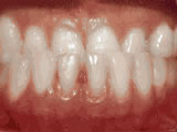 Before treatment